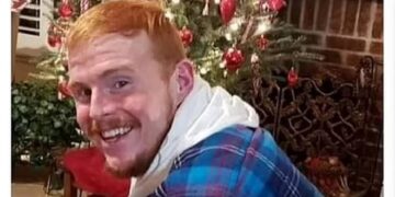 مردی که ۲۰۰ کیلو وزن کم کرد، بدن وحشتناکی داشت.