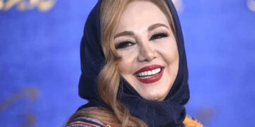 رنگ چشم بهنوش بختیاری ناگهان سبز و زیبا شد!