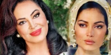 1679040101 عکس قبل از عمل بازیگر 77 ساله سینمای ترکیه فاش