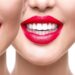 ترفند ساده برای رفع جرم دندان در ۵ دقیقه