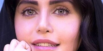 الناز شاکردوست خودش را شبیه به آنجلینا جولی کرده بود.