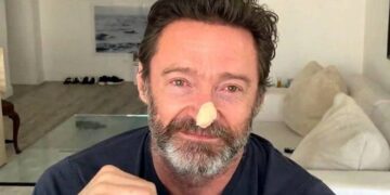 هیو جکمن، بازیگر معروف استرالیایی سرطان پوست دارد