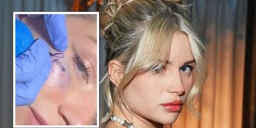 پشیمانی لوتی ماس از خالکوبی صورتش