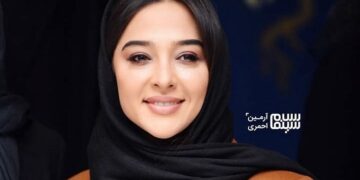 آناهیتا درگاهی با چهره‌ای عجیب دیده شد.