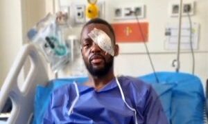 خبر خوش برای استقلالی‌ها؛ عمل جراحی کوین یامگا موفقیت‌آمیز بود