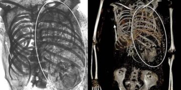 شگفتی باستان‌شناسان از کشف تازه به هنگام عکسبرداری از مومیایی