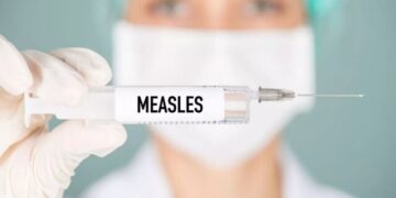 هشدار سازمان بهداشت جهانی: ابتلا به سرخک در اروپا سال ۲۰۲۳ به نسبت سال قبل ۳۰ برابر افزایش داشت