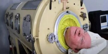 1710487353 مردی که 70 سال با یک ریه آهنی زندگی کرد