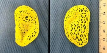 محققان گوش انسان را چاپ کردند