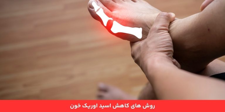 روش های کاهش اسید اوریک خون 