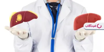 درمان فوری کبد چرب