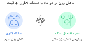 کاهش وزن در دو ماه با دستگاه لاغری + قیمت