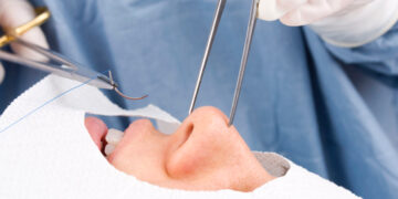 عمل بینی عروسکی