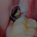 1740023932 771 5 مورد معمول که معمولاً می بینیم