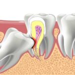 1740023933 967 5 مورد معمول که معمولاً می بینیم