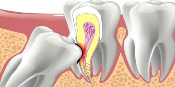 1740023933 967 5 مورد معمول که معمولاً می بینیم