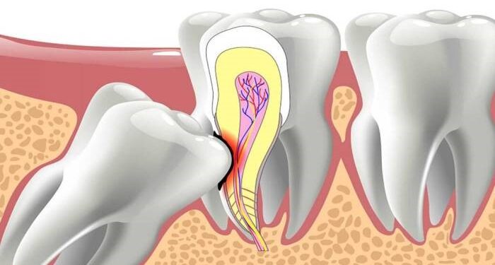 1740023933 967 5 مورد معمول که معمولاً می بینیم