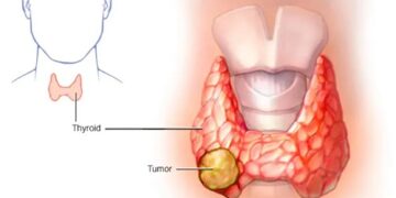 uD62TjcvJ3sMVp5IBujQf20pbVelbzUcYchebWx4