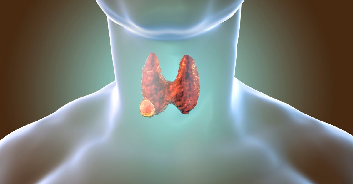 دکتر تیروئید در تهران