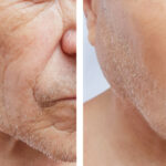 1757498042 277 جوان سازی صورت در تهران با دکتر فریزان نگوشار