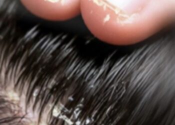 قرص ریجن دایت اسی