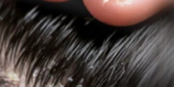 قرص ریجن دایت اسی