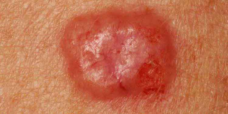 مجهزترین کلینیک درمان ضایعات پوستی در غرب تهران افتتاح شد