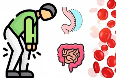 کمبود آهن در بدن