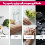 1764859389 747 چاق شدن صورت و زیر چشم چگونه صورت خود را.webp