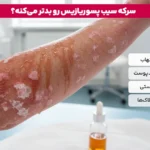 چه کسانی نباید سرکه سیب بخورند؟ | آیا سرکه سیب برای معده مضر است؟ 6 1765035658 403 چه کسانی نباید سرکه سیب بخورند؟ آیا سرکه سیب.webp