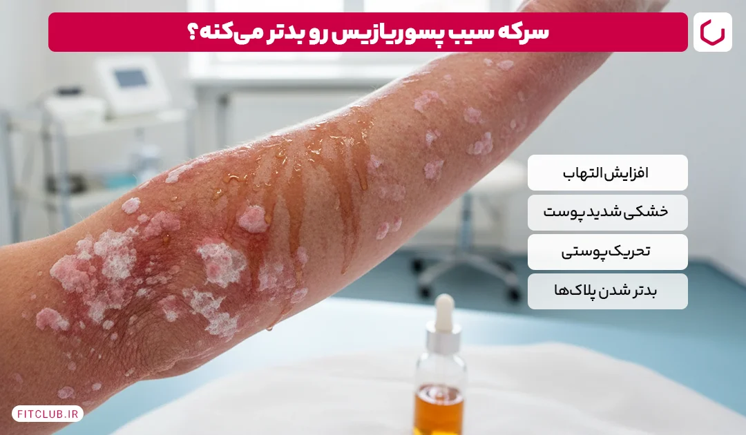 چه کسانی نباید سرکه سیب بخورند؟ | آیا سرکه سیب برای معده مضر است؟ 13 چه کسانی نباید سرکه سیب بخورند؟ افراد مبتلا به مشکلات پوستی فیت کلاب