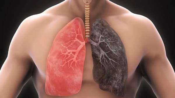 iAeFyA6sJueQvEgcq2t6UGo5iPLa8pO3DedTKKeJ