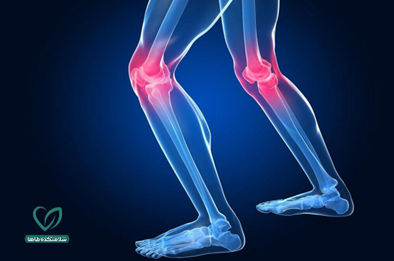 بهترین ورزش برای زانو درد و تقویت مفاصل 3 بهبود درد زانو