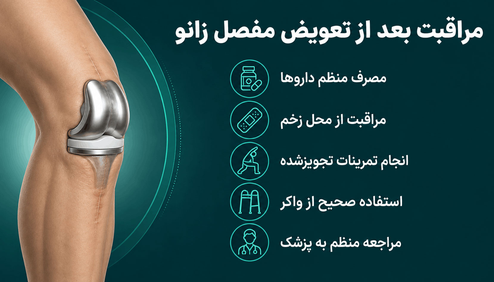 مراقبت های بعد از تعویض مفصل زانو