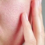 1788279856 519 چگونه منافذ باز پوست را کوچکتر کنیم؟