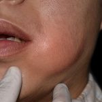 چه چیزی برای عفونت شدید دندان خوب است؟ درمان های خانگی سریع عفونت دندان 3 1788954260 923 چه چیزی برای عفونت شدید دندان خوب است؟ درمان های