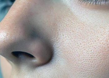 چگونه منافذ باز پوست را کوچکتر کنیم؟