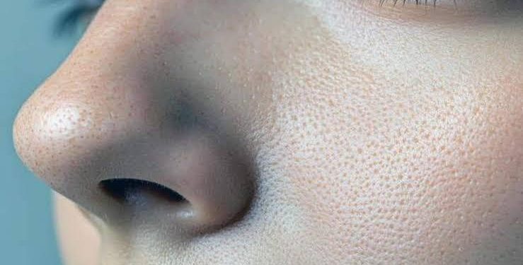 چگونه منافذ باز پوست را کوچکتر کنیم؟