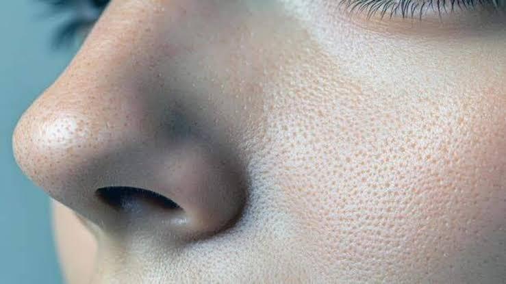 چگونه منافذ باز پوست را کوچکتر کنیم؟