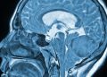 Side view of a blue-toned medical illustration of the human brain in a sagittal section.