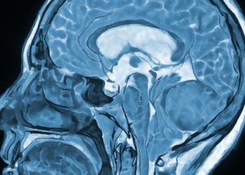 Side view of a blue-toned medical illustration of the human brain in a sagittal section.