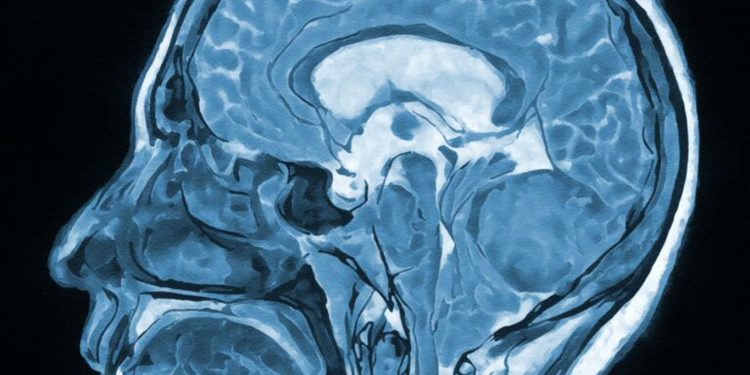 Side view of a blue-toned medical illustration of the human brain in a sagittal section.