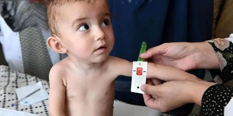 سبد غذایی رایگان برای ۳۳۸ هزار کودک مبتلا به سوءتغذیه 1 سبد غذایی رایگان برای ۳۳۸ هزار کودک مبتلا به سوءتغذیه
