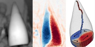 Triptych dental images: left X-ray of a tooth; middle blue/red stress map; right 3D tooth model with color stress regions and displacement arrows.