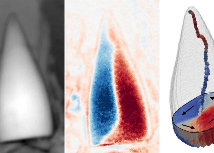 Triptych dental images: left X-ray of a tooth; middle blue/red stress map; right 3D tooth model with color stress regions and displacement arrows.