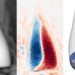 Triptych dental images: left X-ray of a tooth; middle blue/red stress map; right 3D tooth model with color stress regions and displacement arrows.