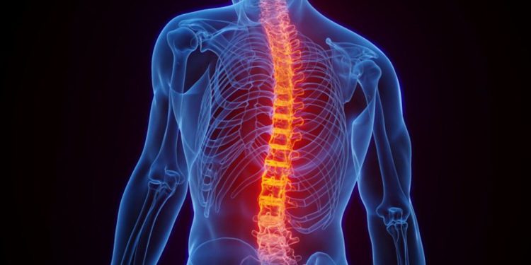 چرا نخستین پیوند نخاع در جهان تا این اندازه بحث‌برانگیز است؟
